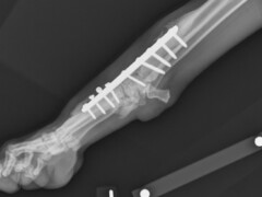 Chirurgie orthopédique Chirurgie orthopédique