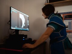 Radiographie numérique Radiographie